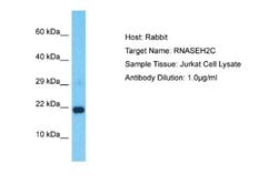 RNASEH2C Rabbit anti-Human, Polyclonal, Novus Biologicals 0.1 mL | Buy Online | Novus Biologicals | Fisher Scientific